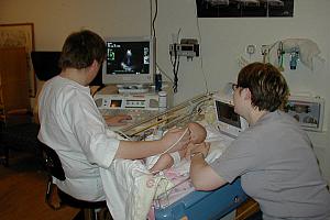 Un million $ à quatre CSSS projets d'immobilisation en pédiatrie